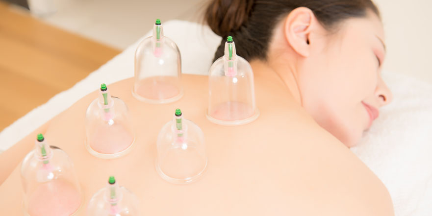 Cupping as part of acupuncture